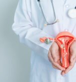 State-of-the-art facility for fibroids treatment in Hyderabad