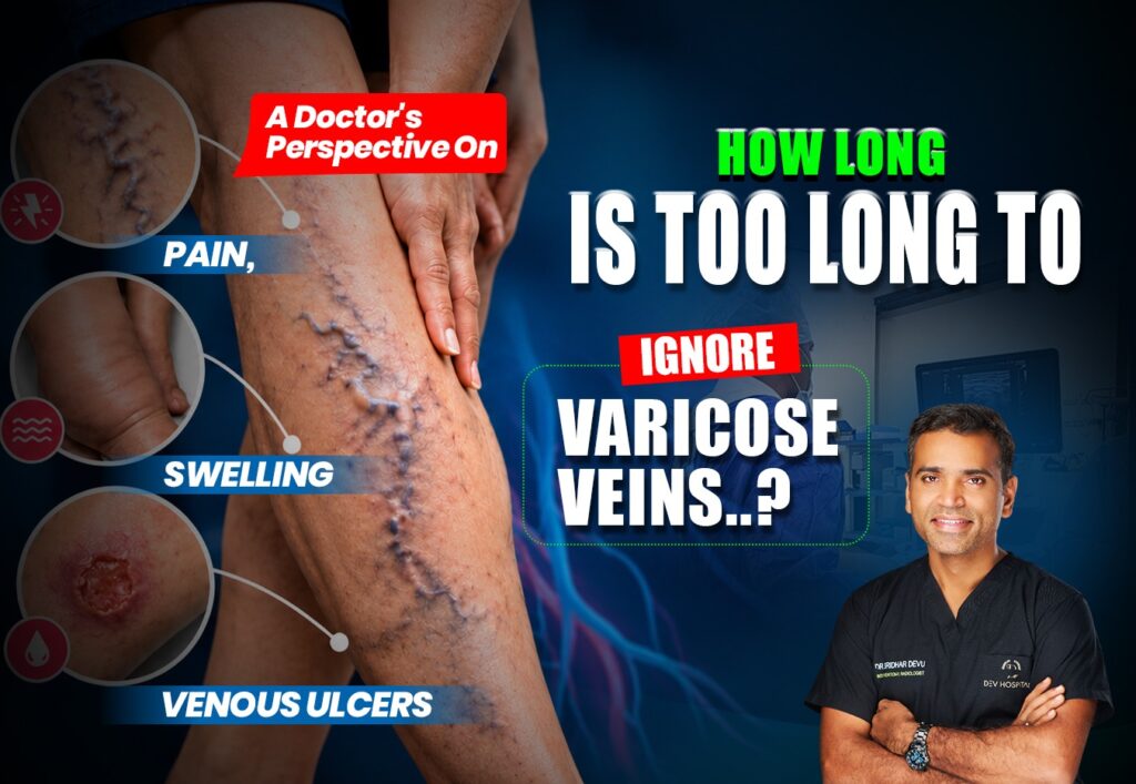 Varicose veins with pain, swelling and venous ulcers explained by a vascular surgeon