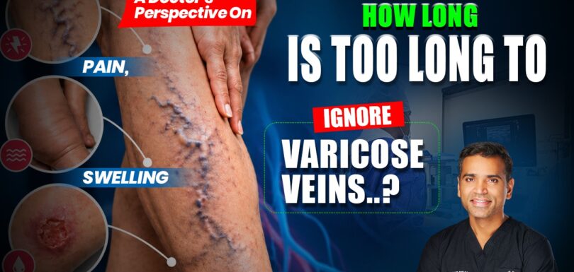 Varicose veins with pain, swelling and venous ulcers explained by a vascular surgeon